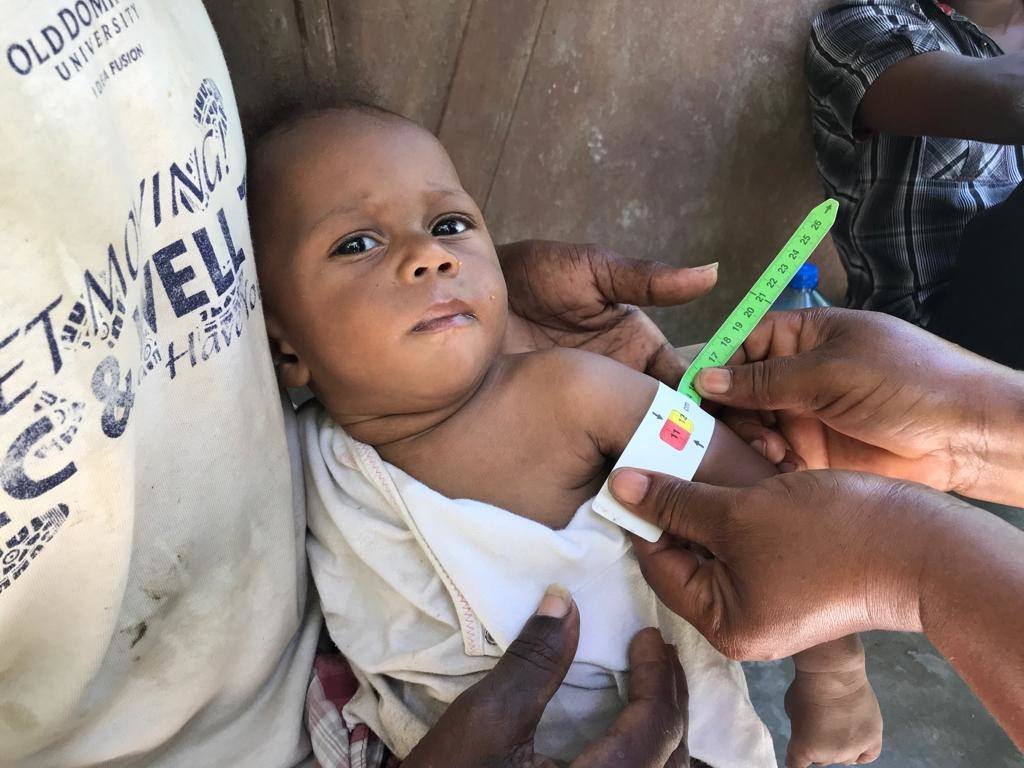 Dieuthro's Story - From Malnourished To Thriving
